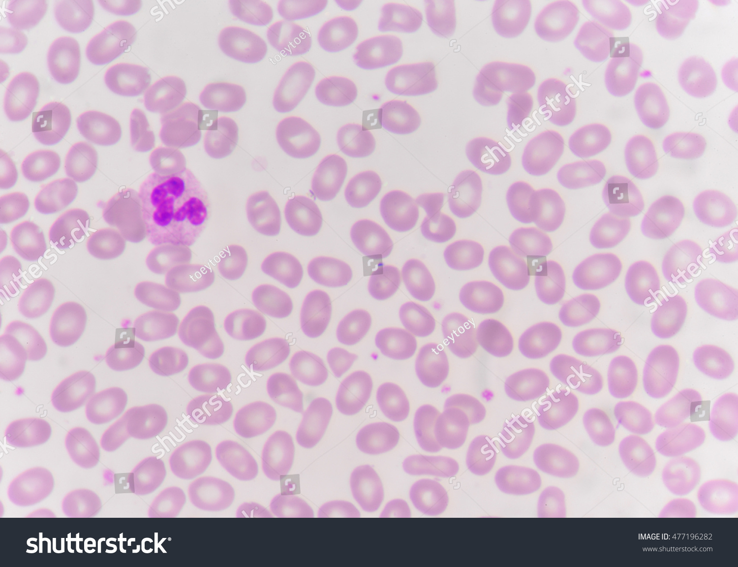 Red Blood Cells White Blood Cells Stock Photo 477196282 | Shutterstock