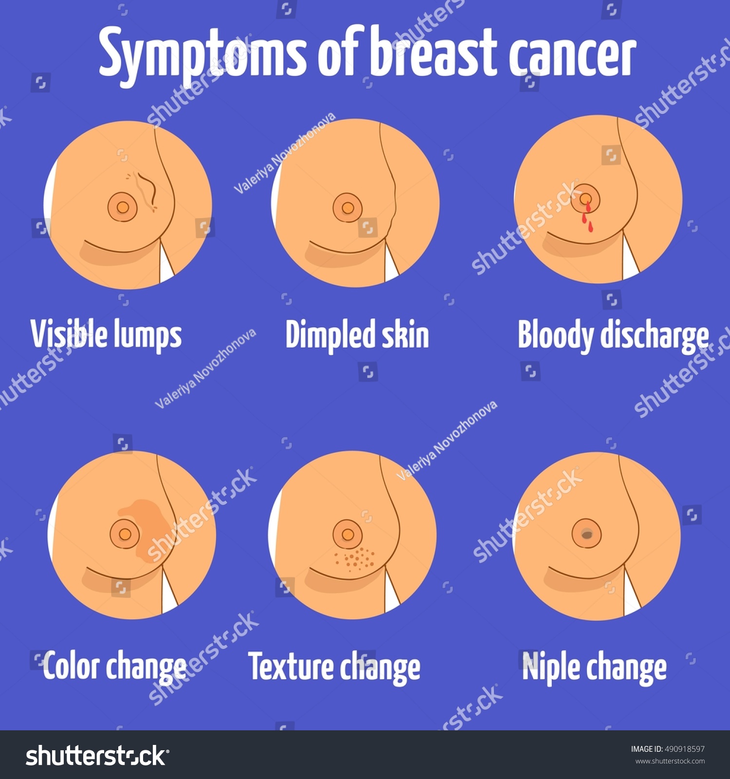 11 Symptoms Of Breast Cancer In Women That Aren't Lumps