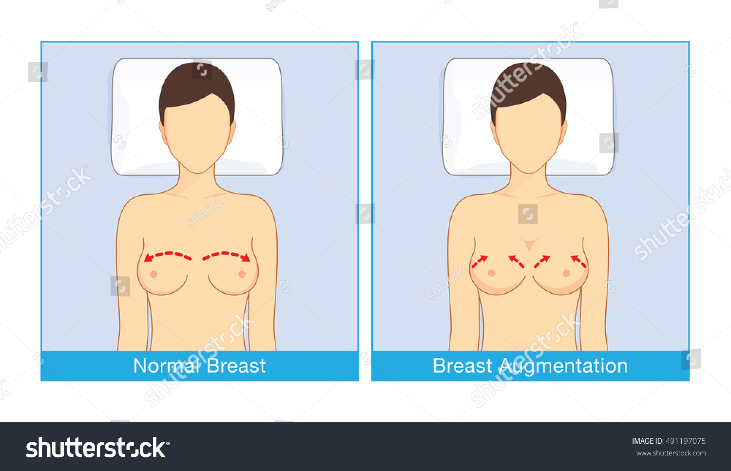 Average Breast Pics