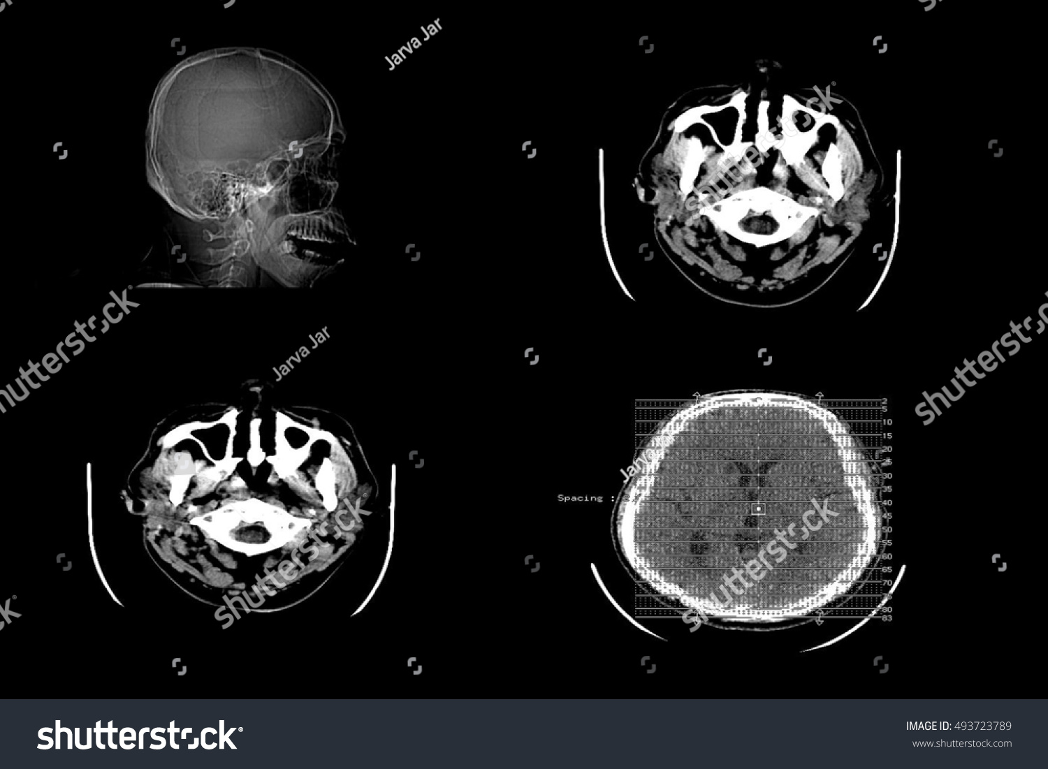 ct scan brain hindi