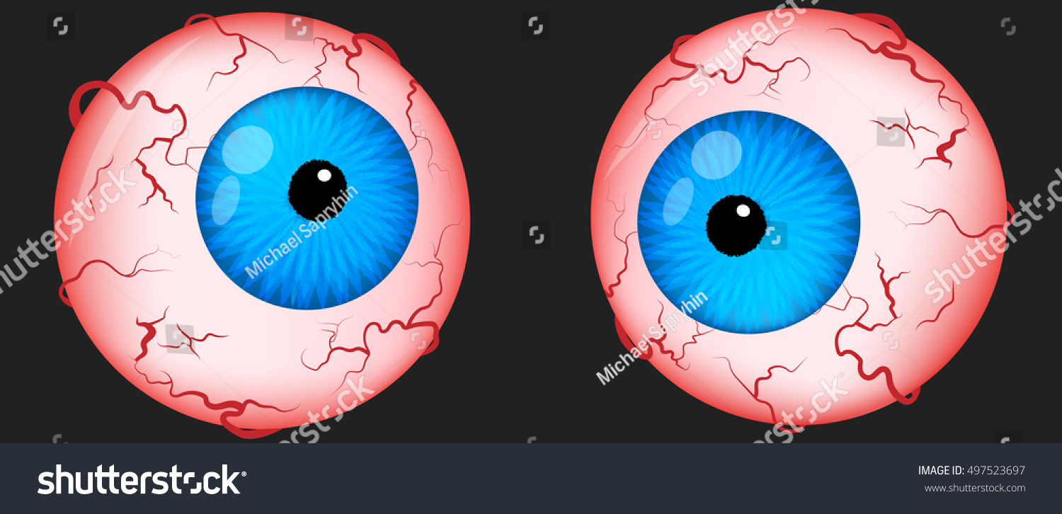 Eyeballs Scary Halloween Irritated Eyes Venis Stock Vector (Royalty ...