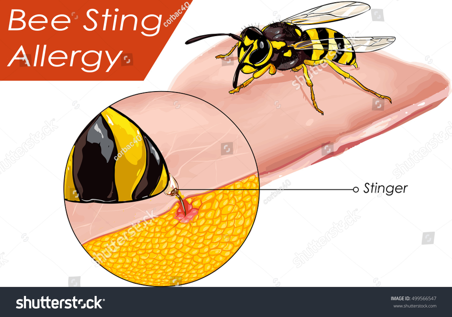 Пчелы кусают иллюстрация