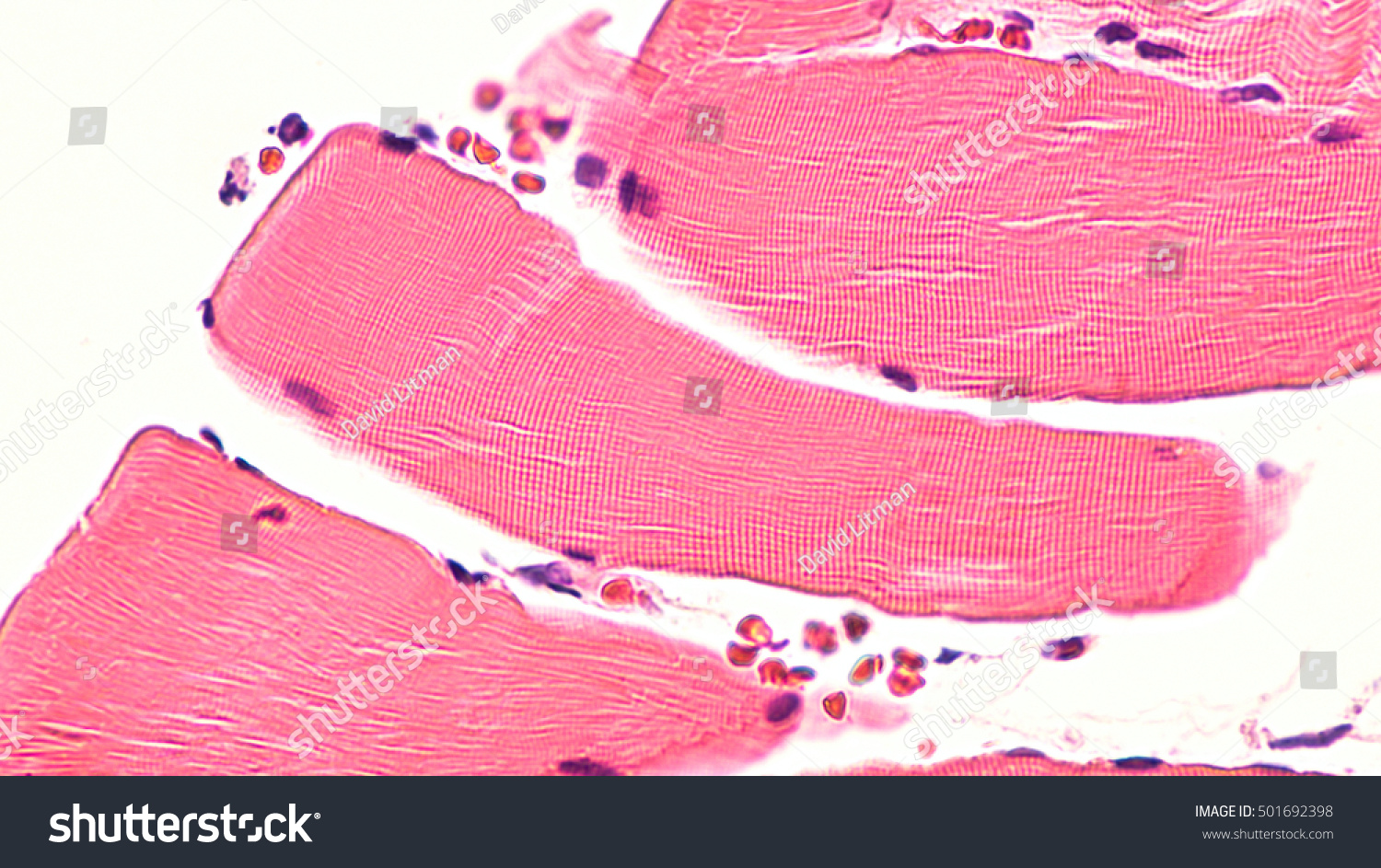 Skeletal Muscle Cross Section Human Skeletal Stock Photo 501692398 ...