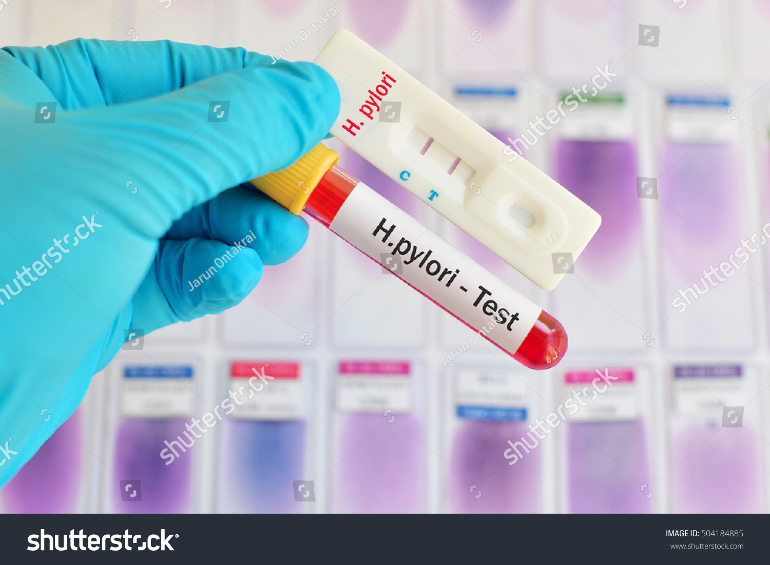 Helicobacter Pylori H Pylori Testing By库存照片504184885 | Shutterstock