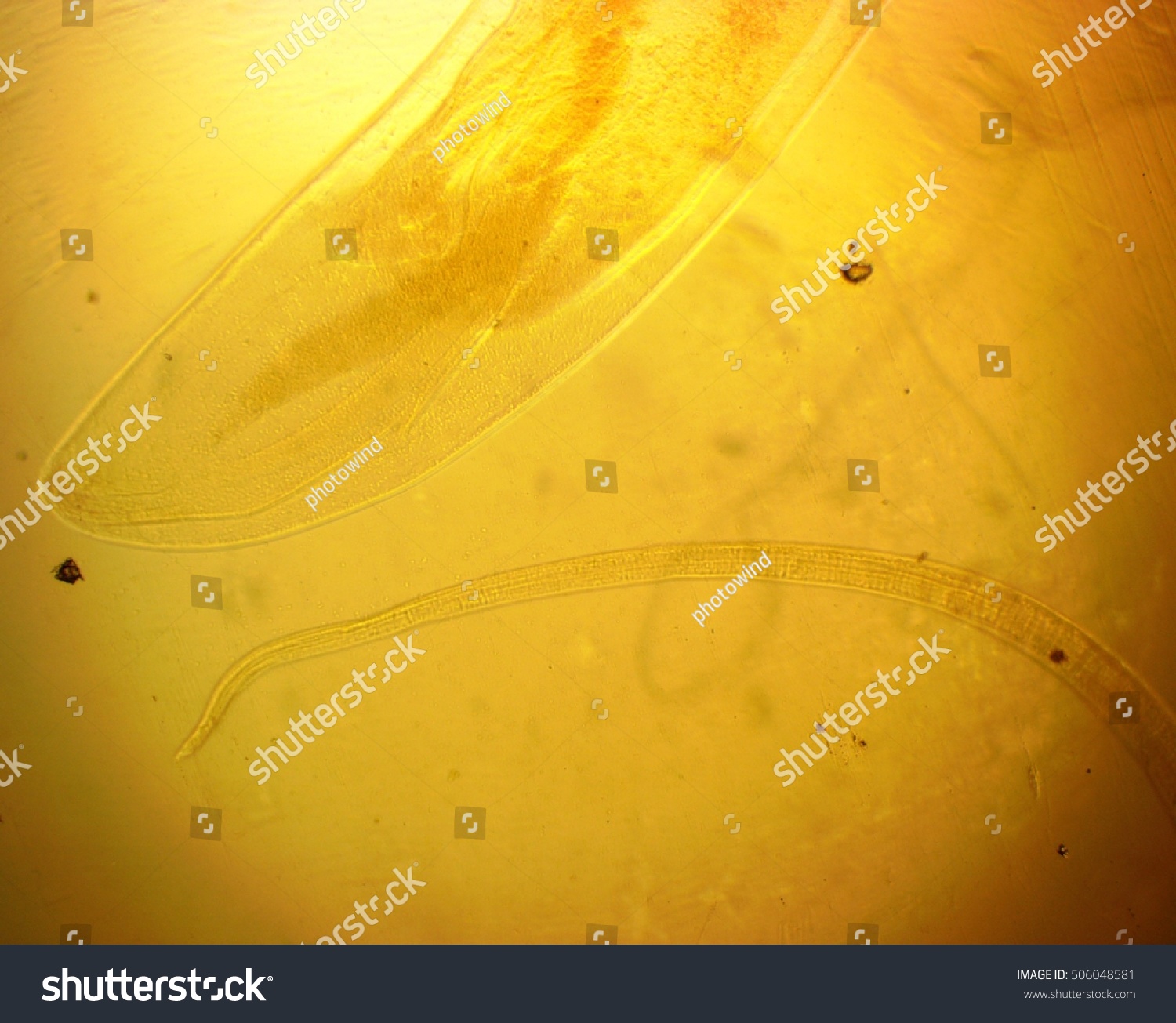 Human Whipworm Trichuris Trichiura Female Permanent Stock Photo ...