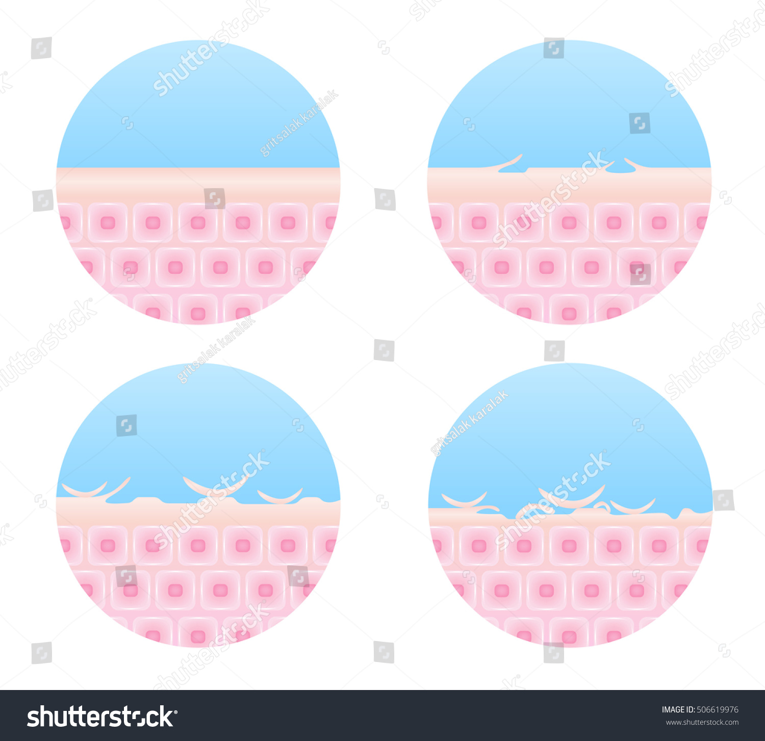 Step Healthy Dry Skin Icon Vector Stock Vector (Royalty Free) 506619976 ...