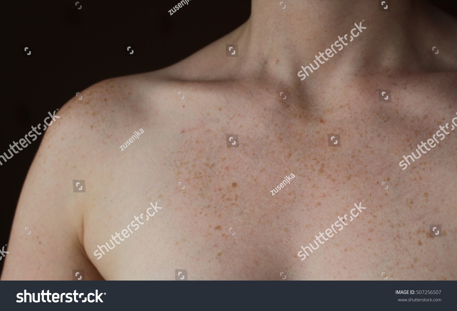 Freckle Chested