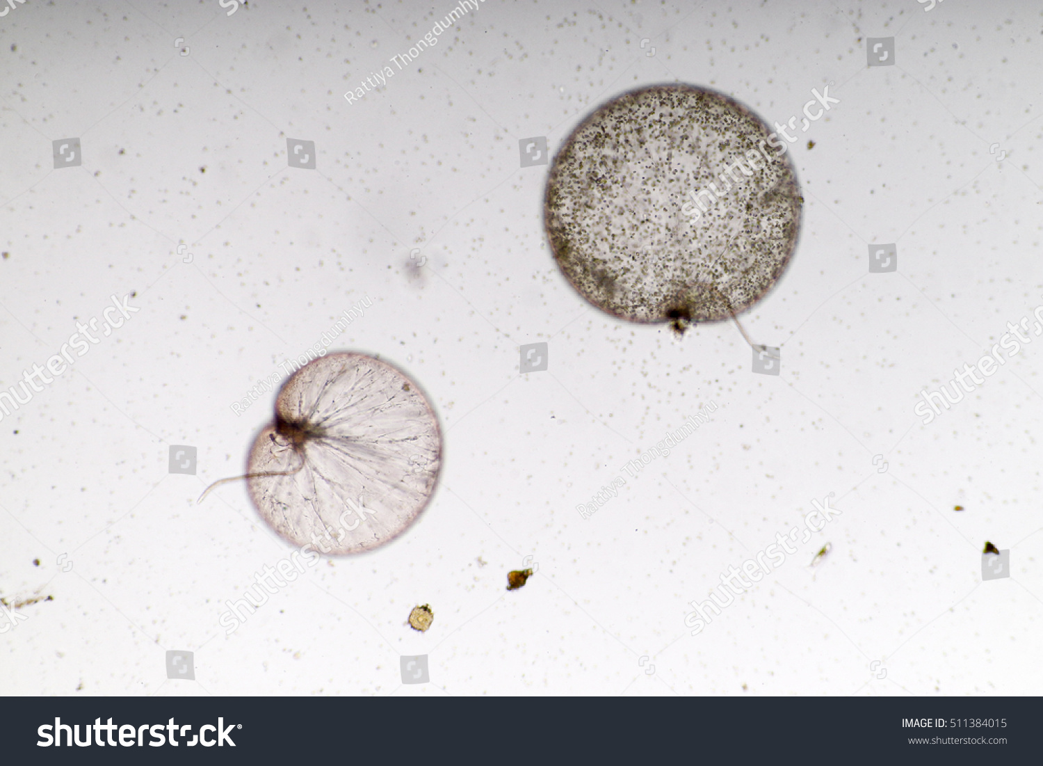 Noctiluca Dinoflagellate Marine Protozoa Under Microscope Stock Photo ...