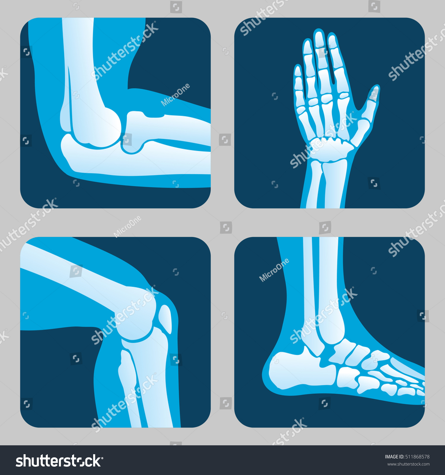 Human Joints Knee Joint Elbow Joint Stock Illustration 511868578 ...