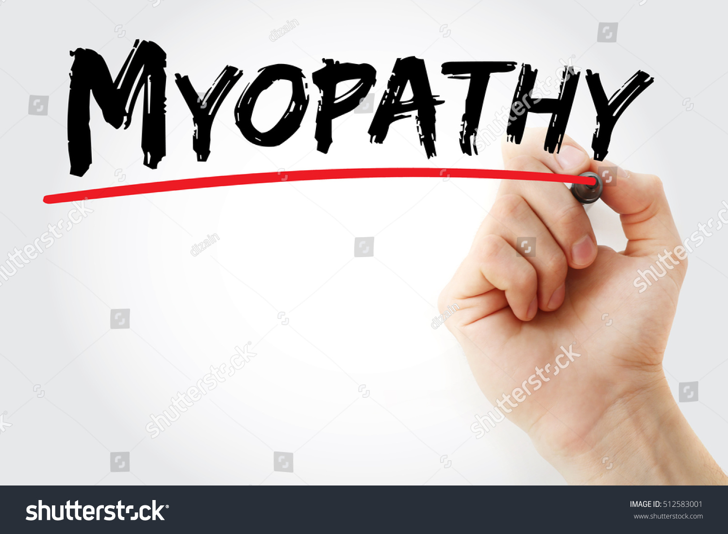 Myopathy Disease Muscle Which Muscle Fibers Stock Photo 512583001 ...