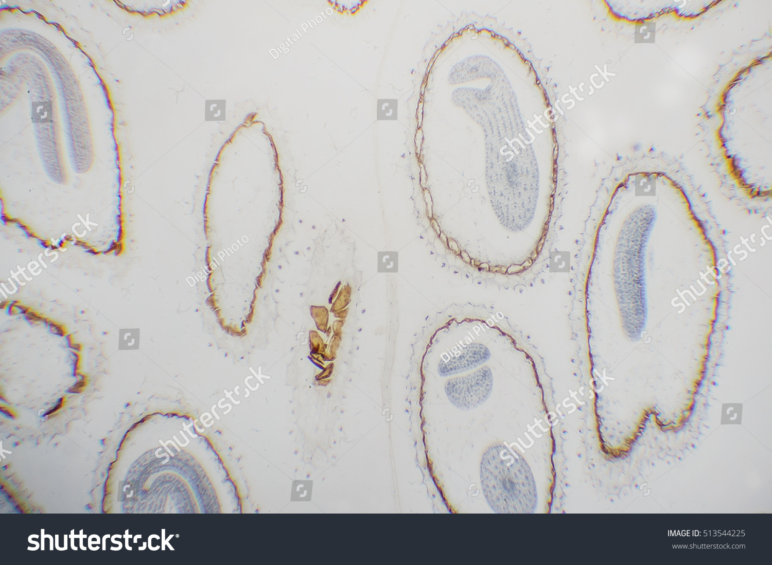 Slice Capsella Embryo Microscopic Micrograph Plant Stock Photo ...