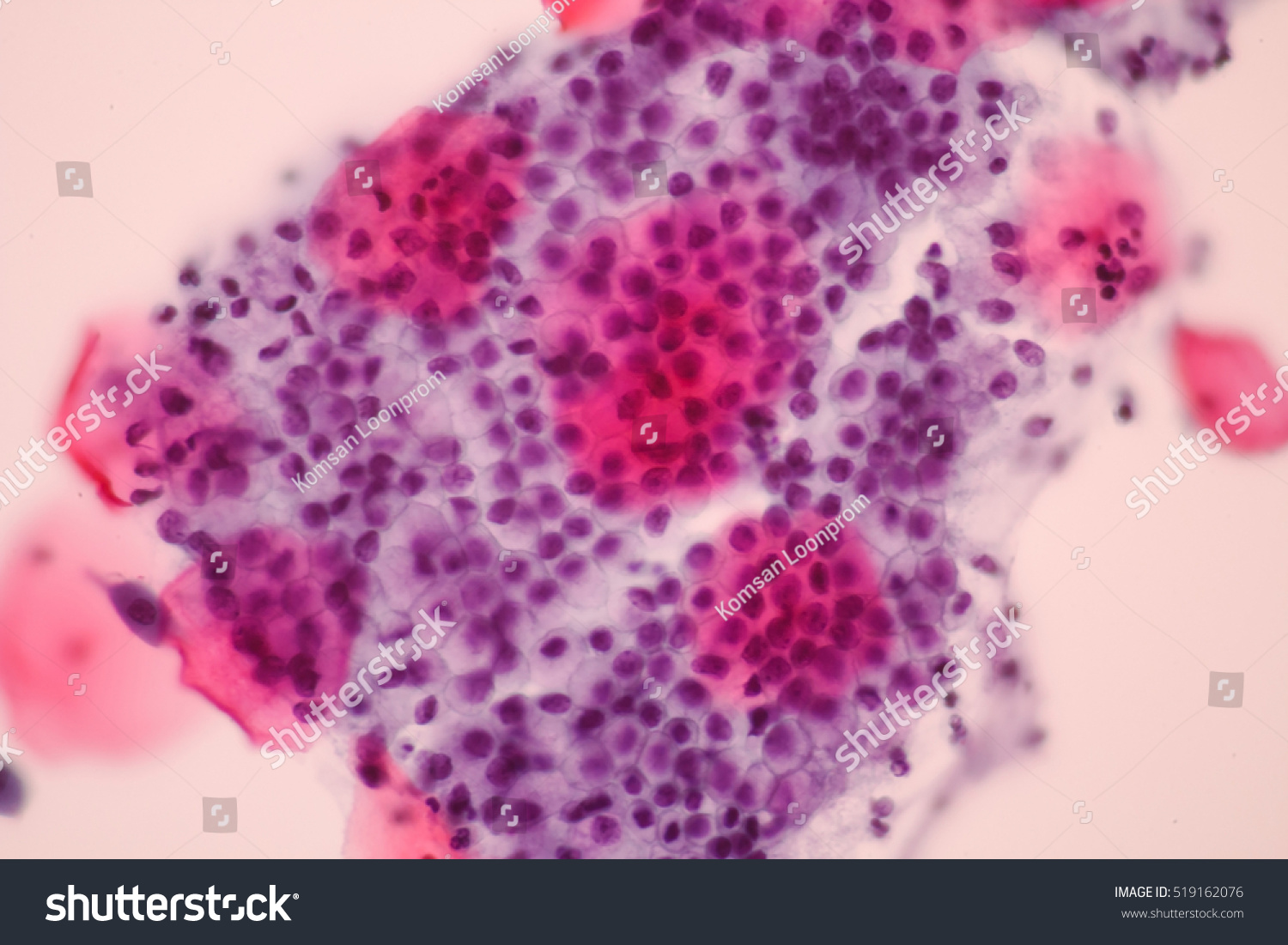 View Microscopic Glandular Epithelial Cells Pap Stock Photo 519162076 ...