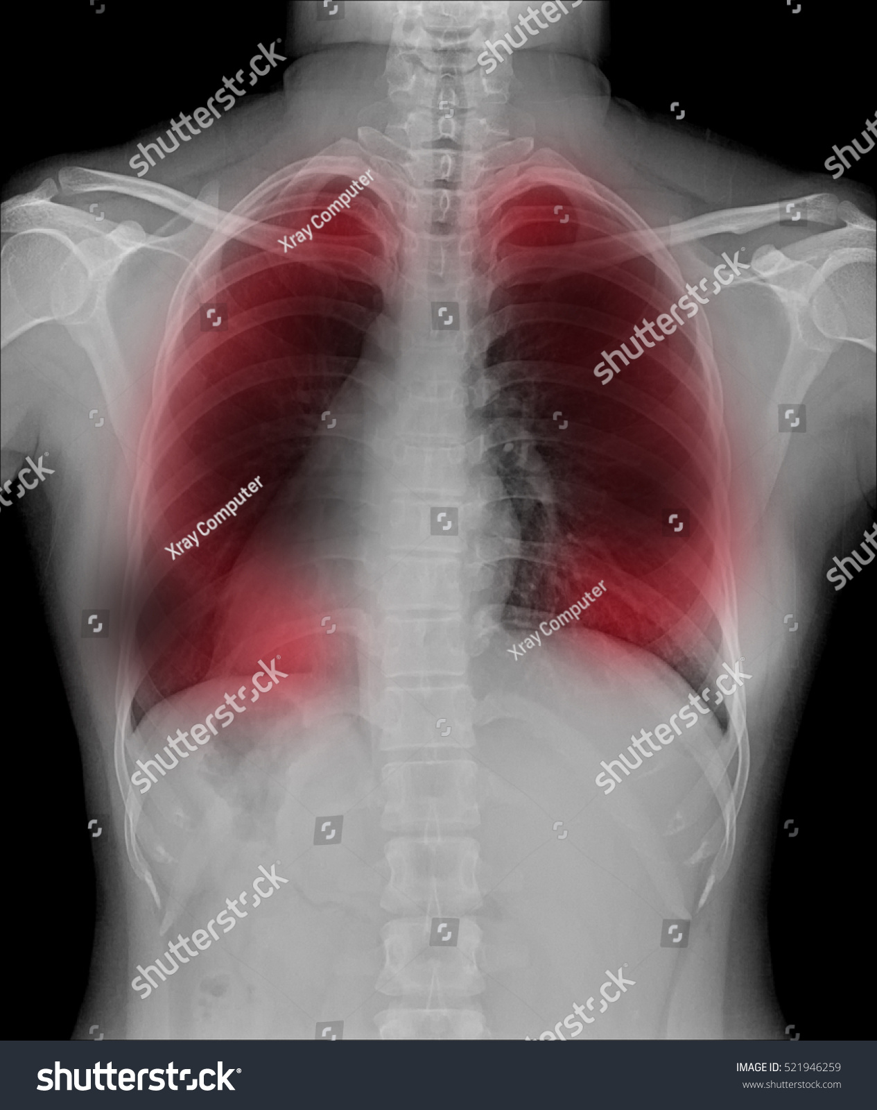 View Human Xray Film Taken Examine Stock Photo 521946259 | Shutterstock