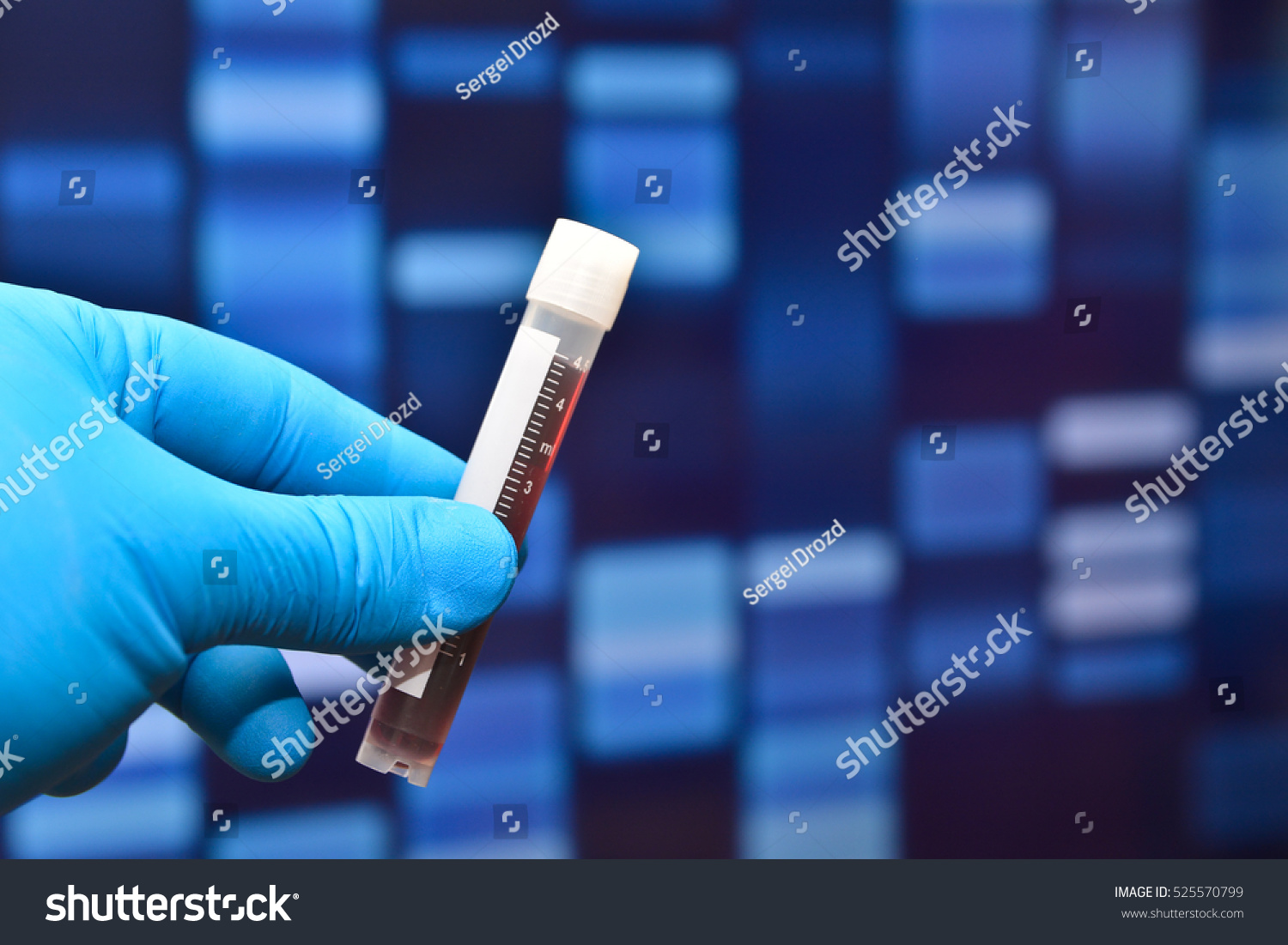 laboratory-tests-medicine-test-tube-sample-stock-photo-525570799