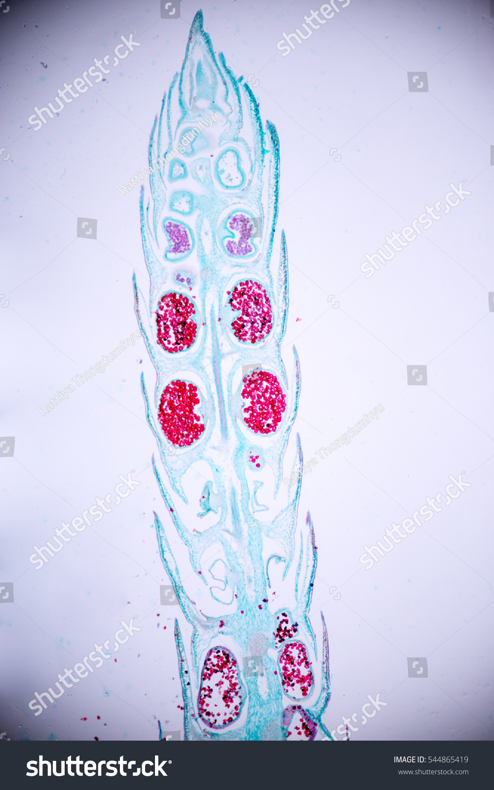 Strobilus Selaginella Under Microscope View Stock Photo 544865419 ...