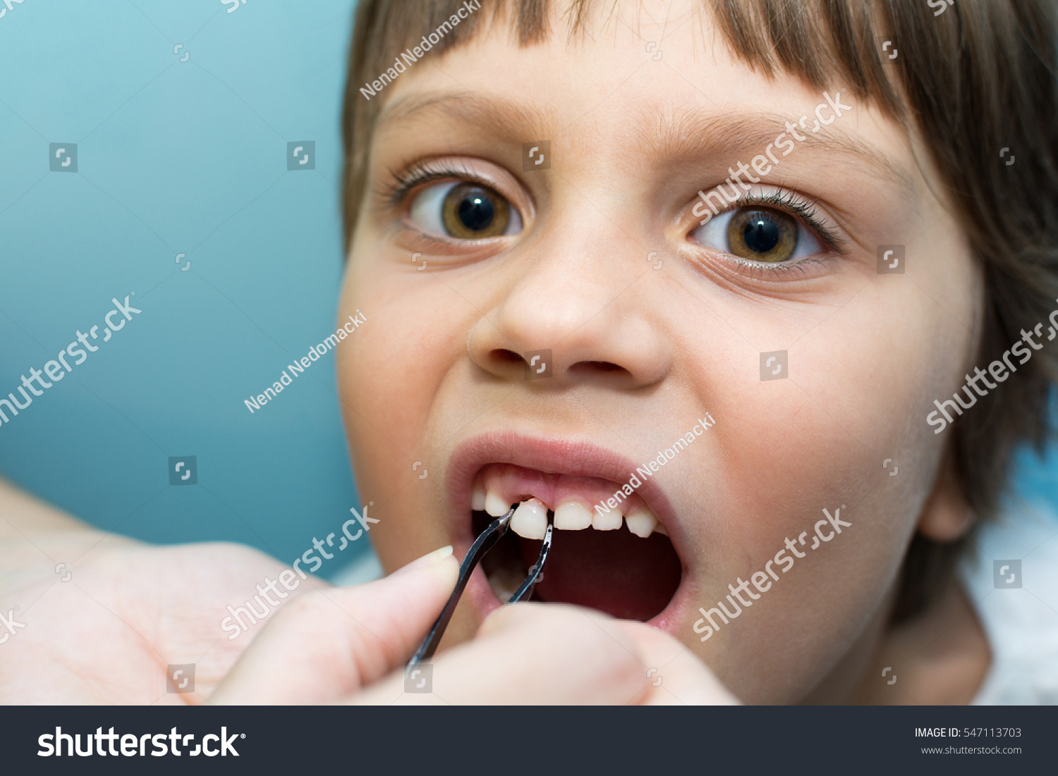 черные зубы картинки