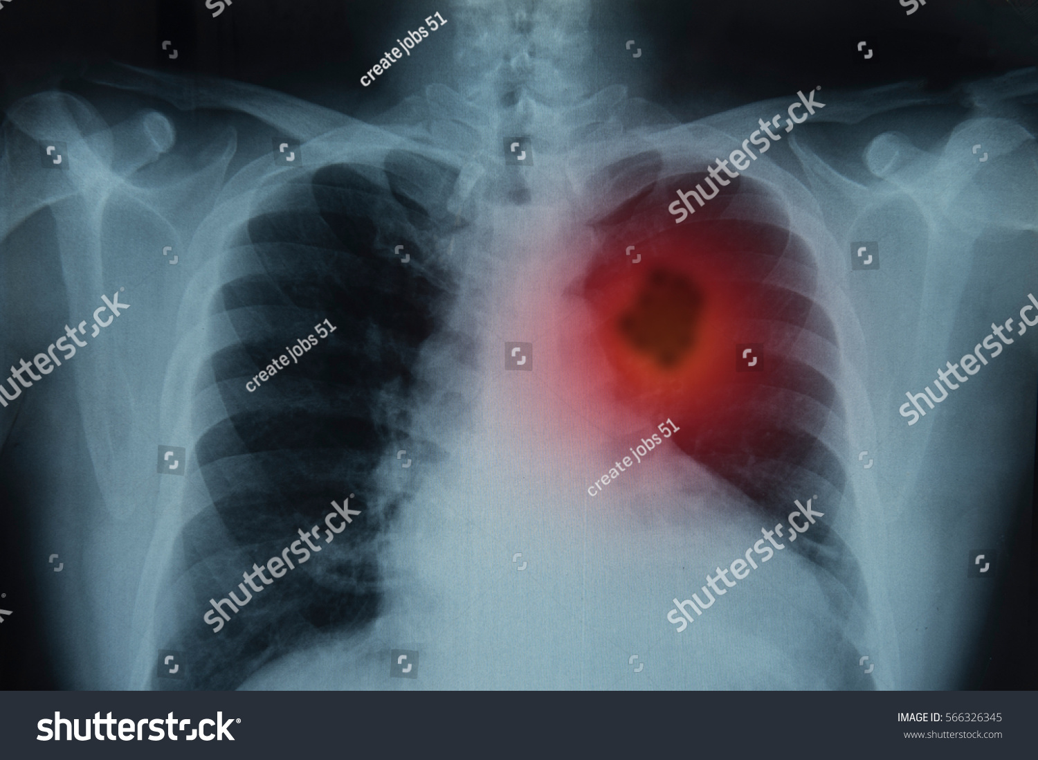 4,110 Human thorax Stock Photos, Images & Photography | Shutterstock