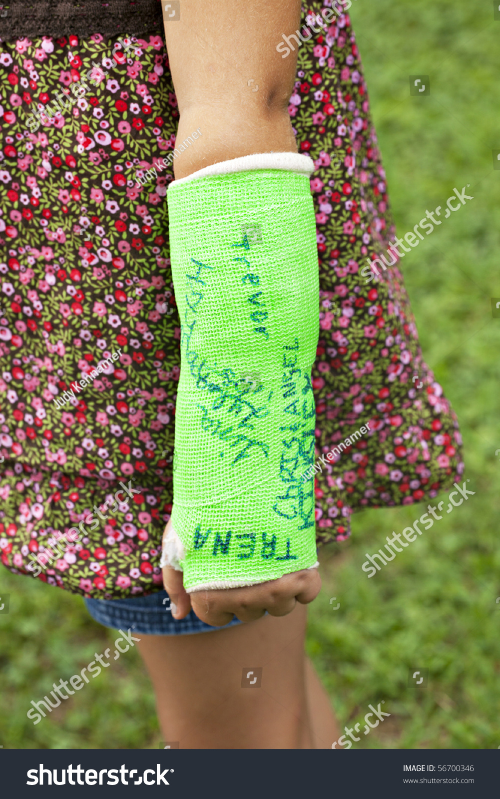 green arm cast