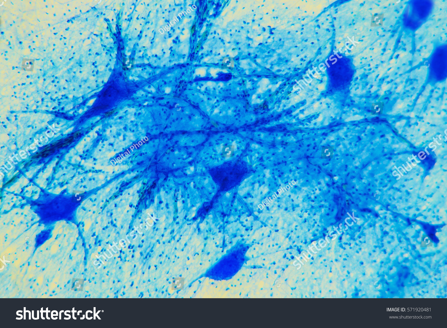 Science Background Neuron Tissue Nerve Fibers Stock Photo 571920481 ...