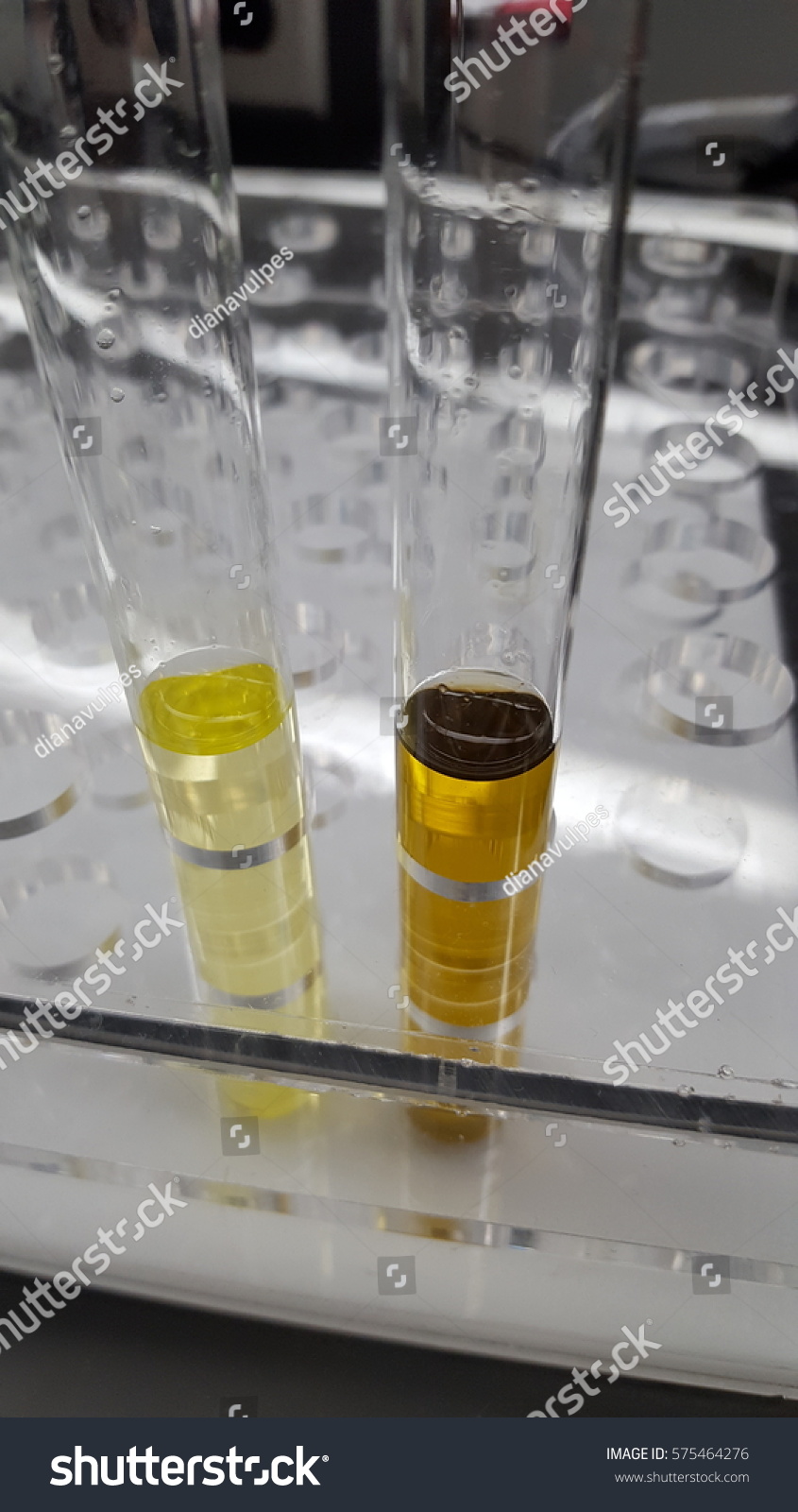 Negative Positive Control Urine Specimens Urinalysis Stock Photo ...