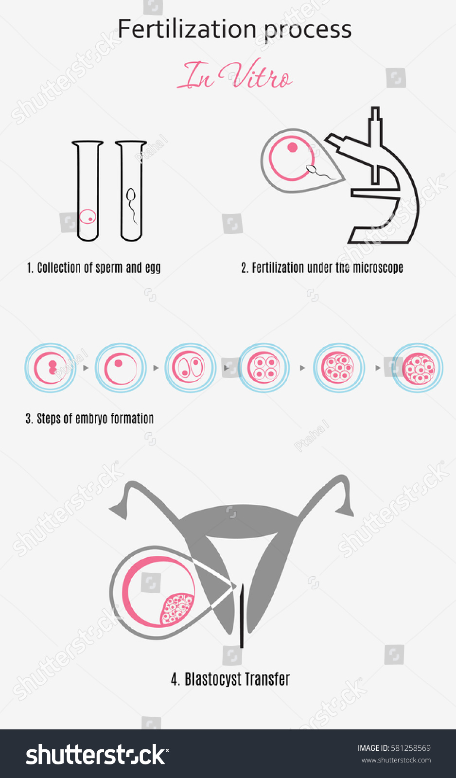 Vitro Fertilization Infographic Chart Scheme Artificial Stock Vector Royalty Free 581258569 0704