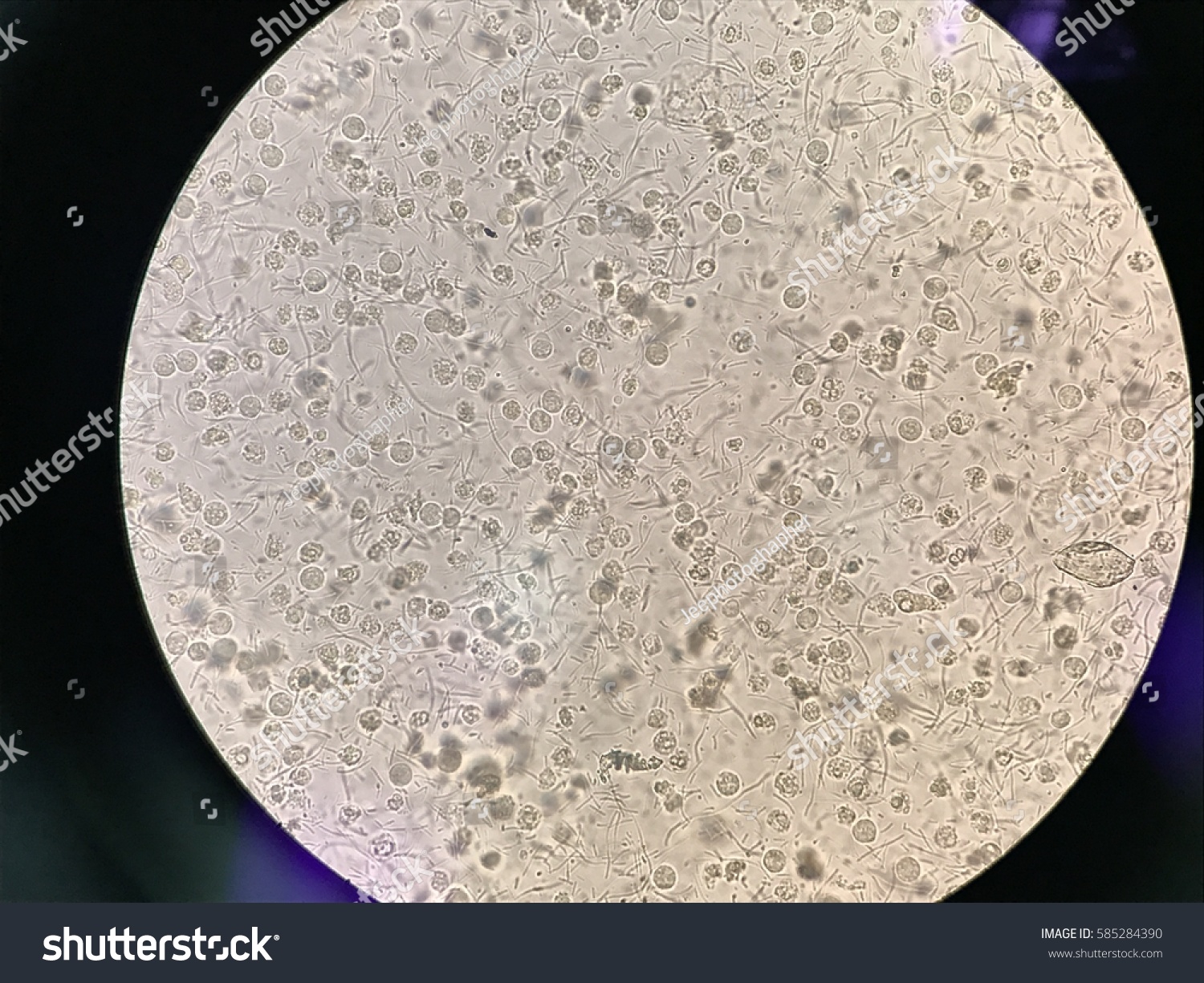 Urinary Tract Infectionview Images Microscope Show Stock Photo ...