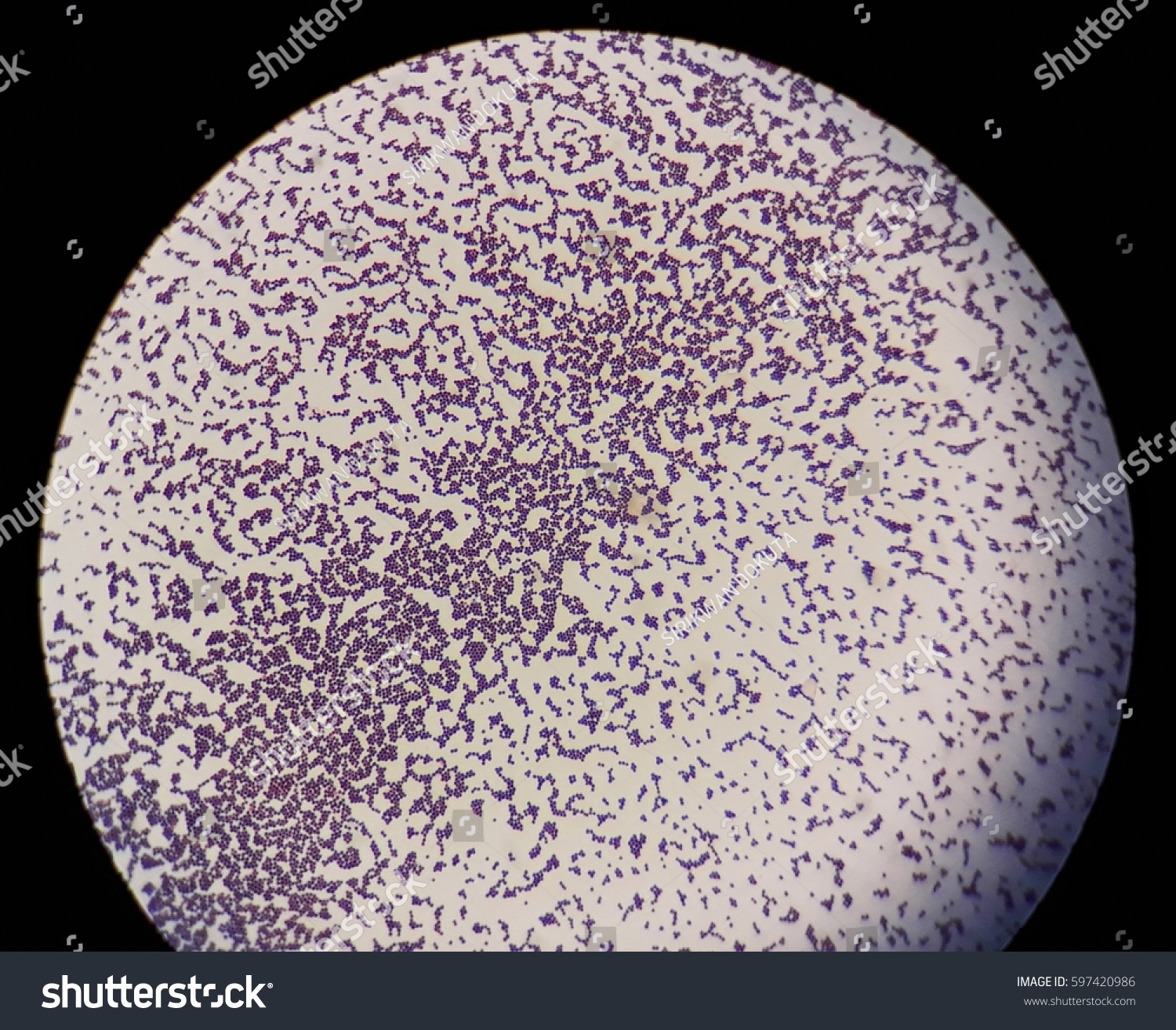 cocci bacteria under microscope