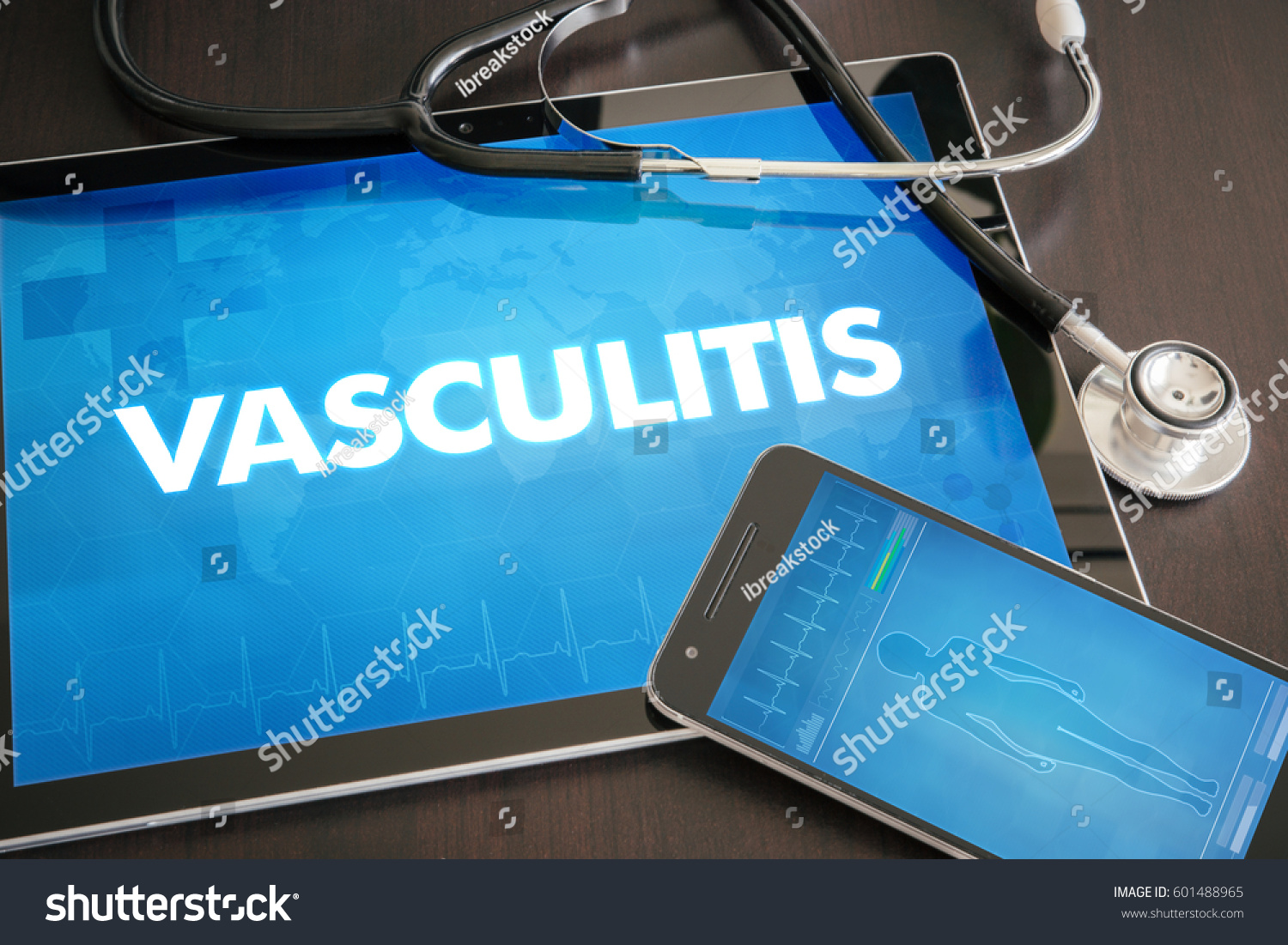 Vasculitis Heart Disorder Diagnosis Medical Concept Stock Photo ...