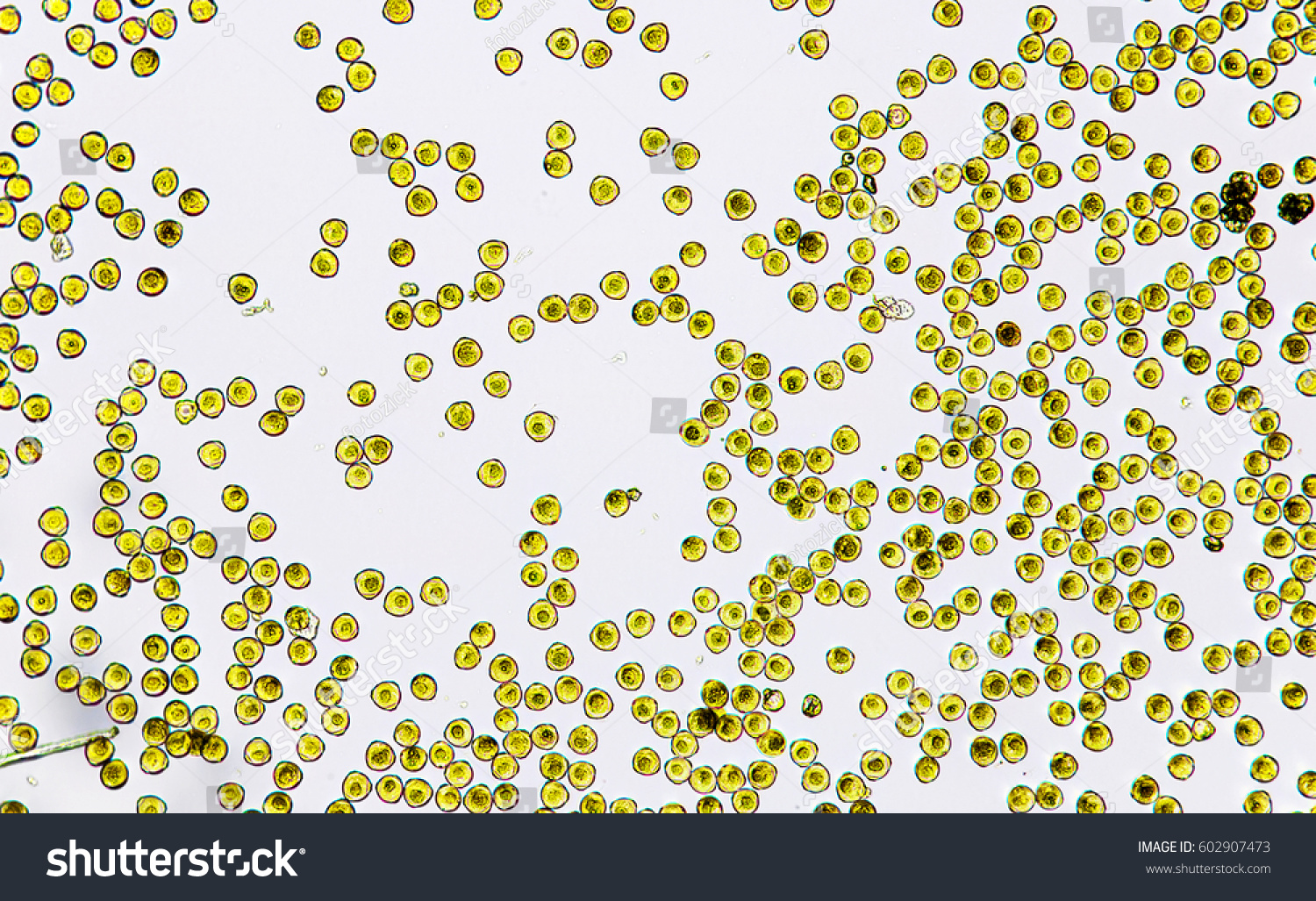 Pollen Hazelnut Under Microscope Stock Photo 602907473 | Shutterstock