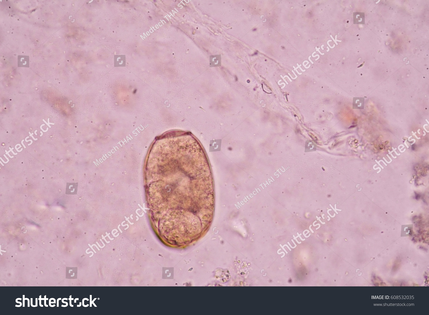 Under Microscopy Showing Paragonimus Westermani Egg Stock Photo