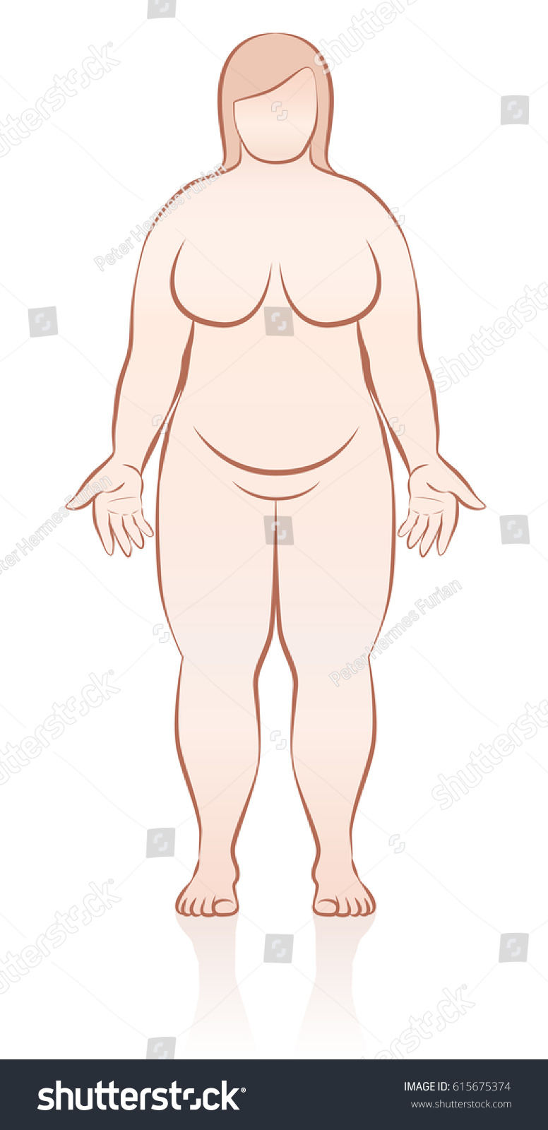 Fat Naked Woman Schematic Medical Representation Stock Vector Royalty Free