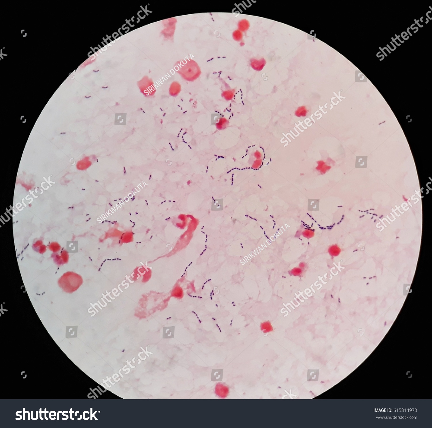 Smear Human Blood Culture Grams Stained Stock Photo 615814970 ...