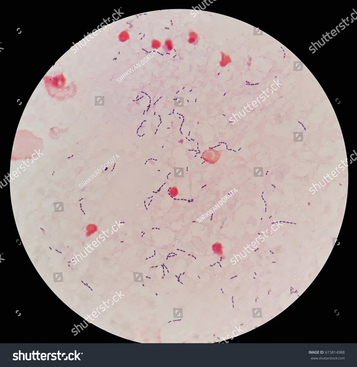 Smear Human Blood Culture Grams Stained Stock Photo 615814988 