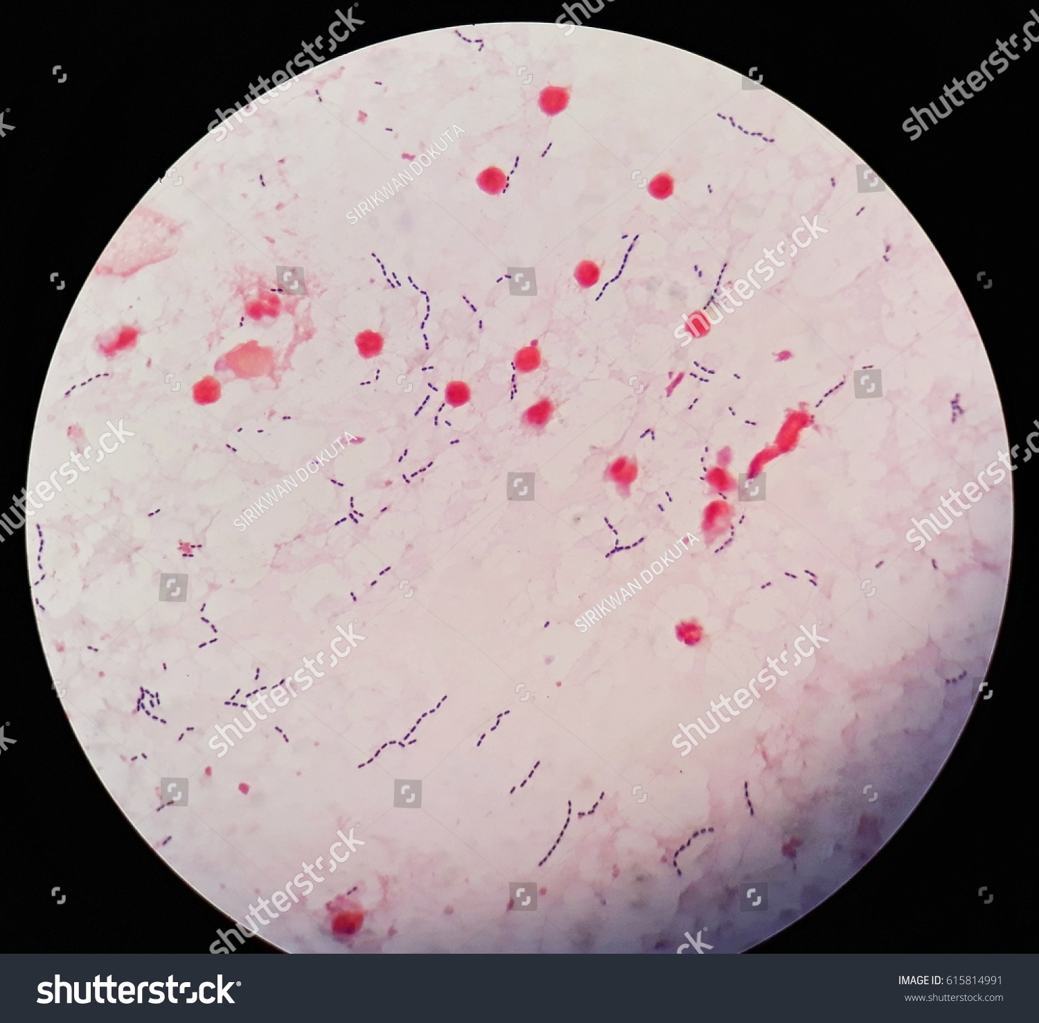 Smear Human Blood Culture Grams Stained Stock Photo 615814991 ...