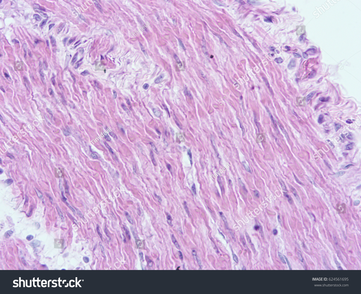 Histology Smooth Muscle Uterine Wall Show Stock Photo 624561695 ...