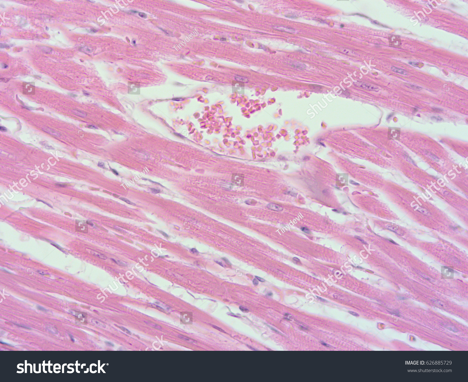 Histology Rat Heart Show Cardiac Tissue Stock Photo 626885729 ...