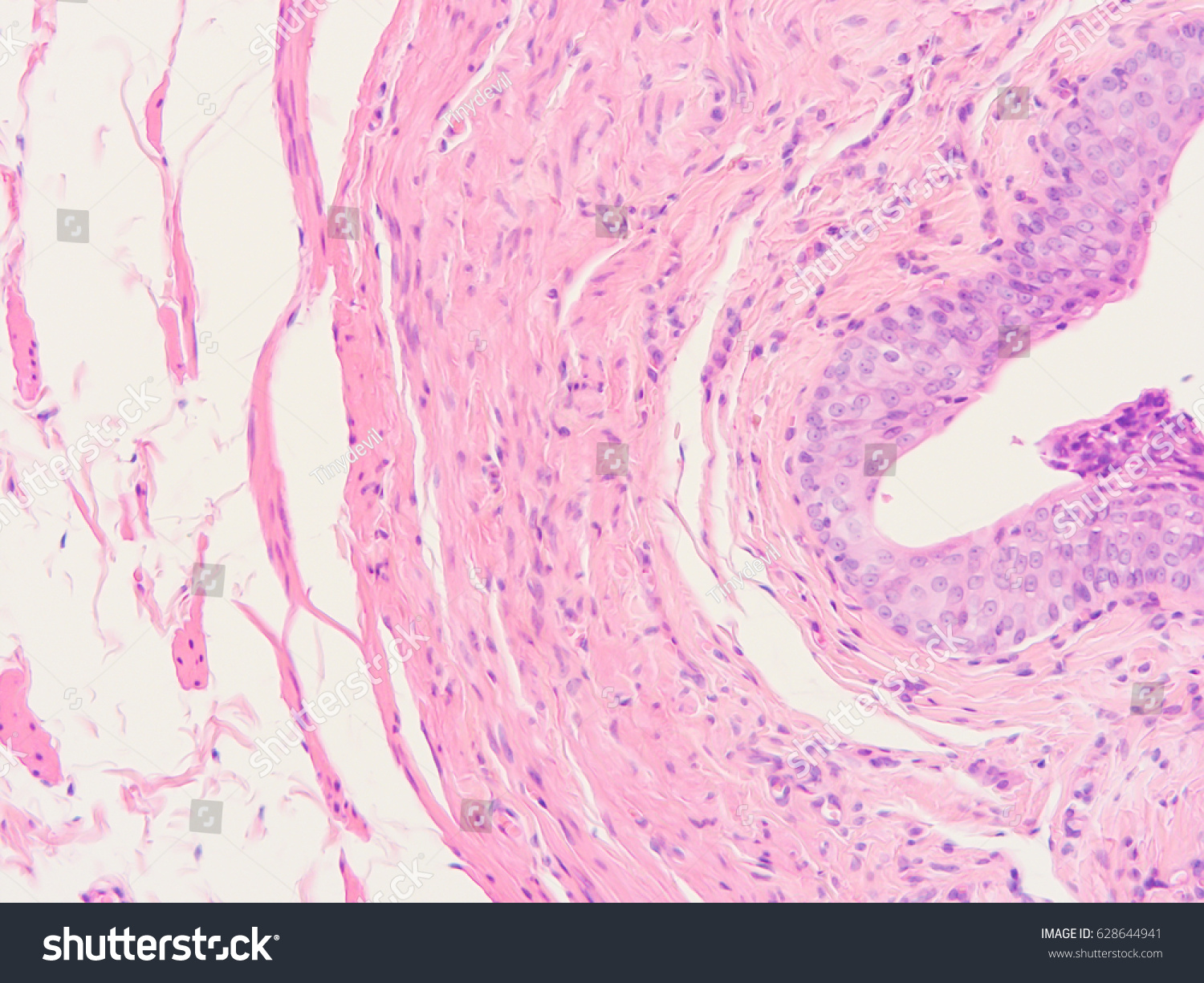 Histology Human Intestine Show Transitional Epithelium Stock Photo ...