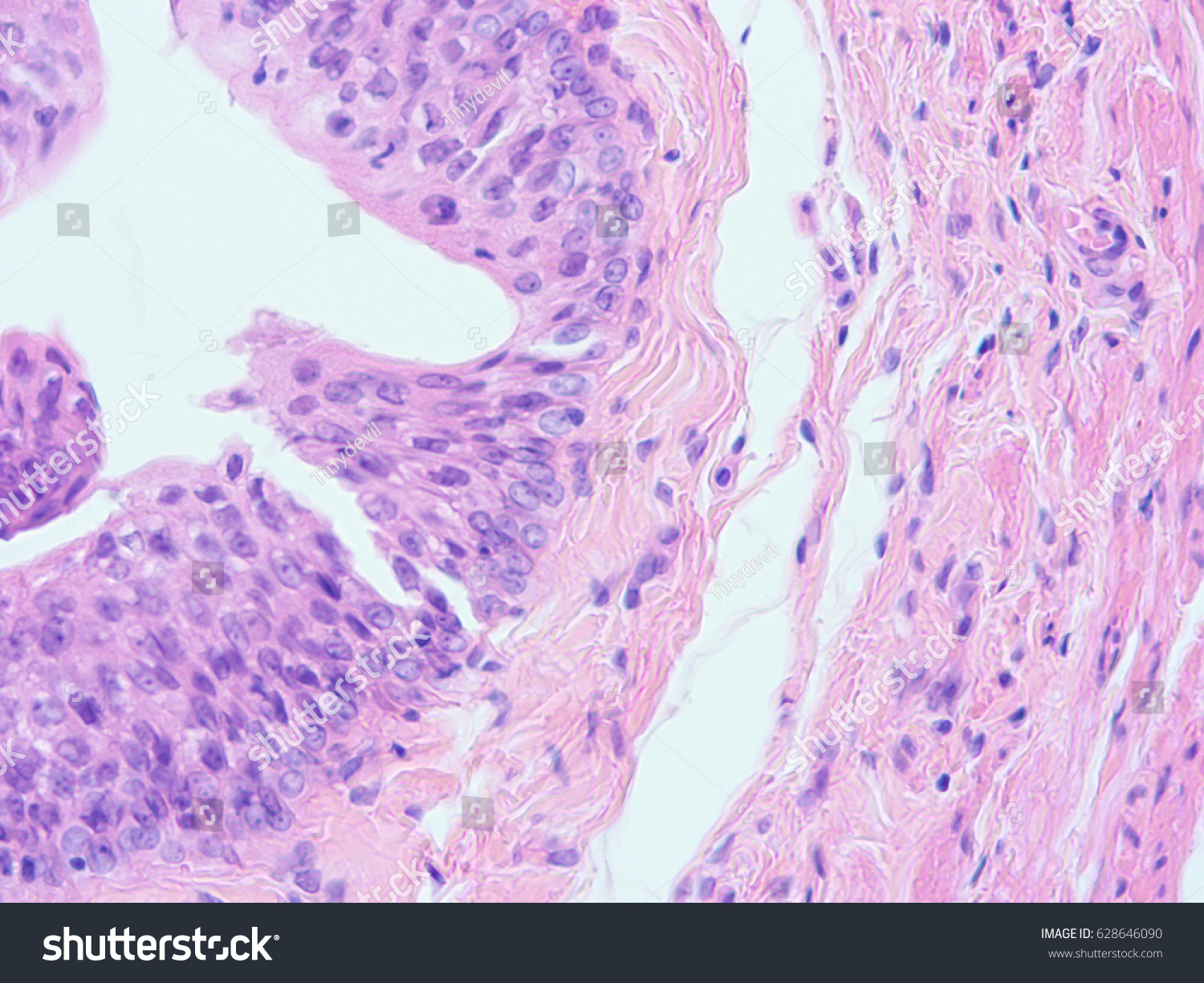 Histology Human Tissue Show Transitional Epithelium Stock Photo ...