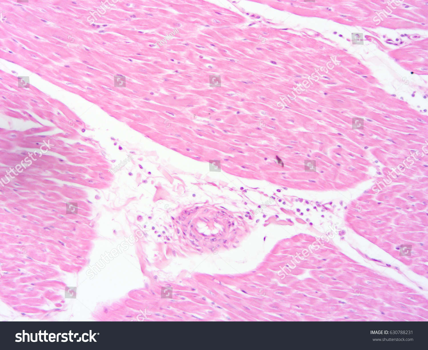 Histology Human Heart Tissue Show Cardiac ภาพสต็อก 630788231 | Shutterstock