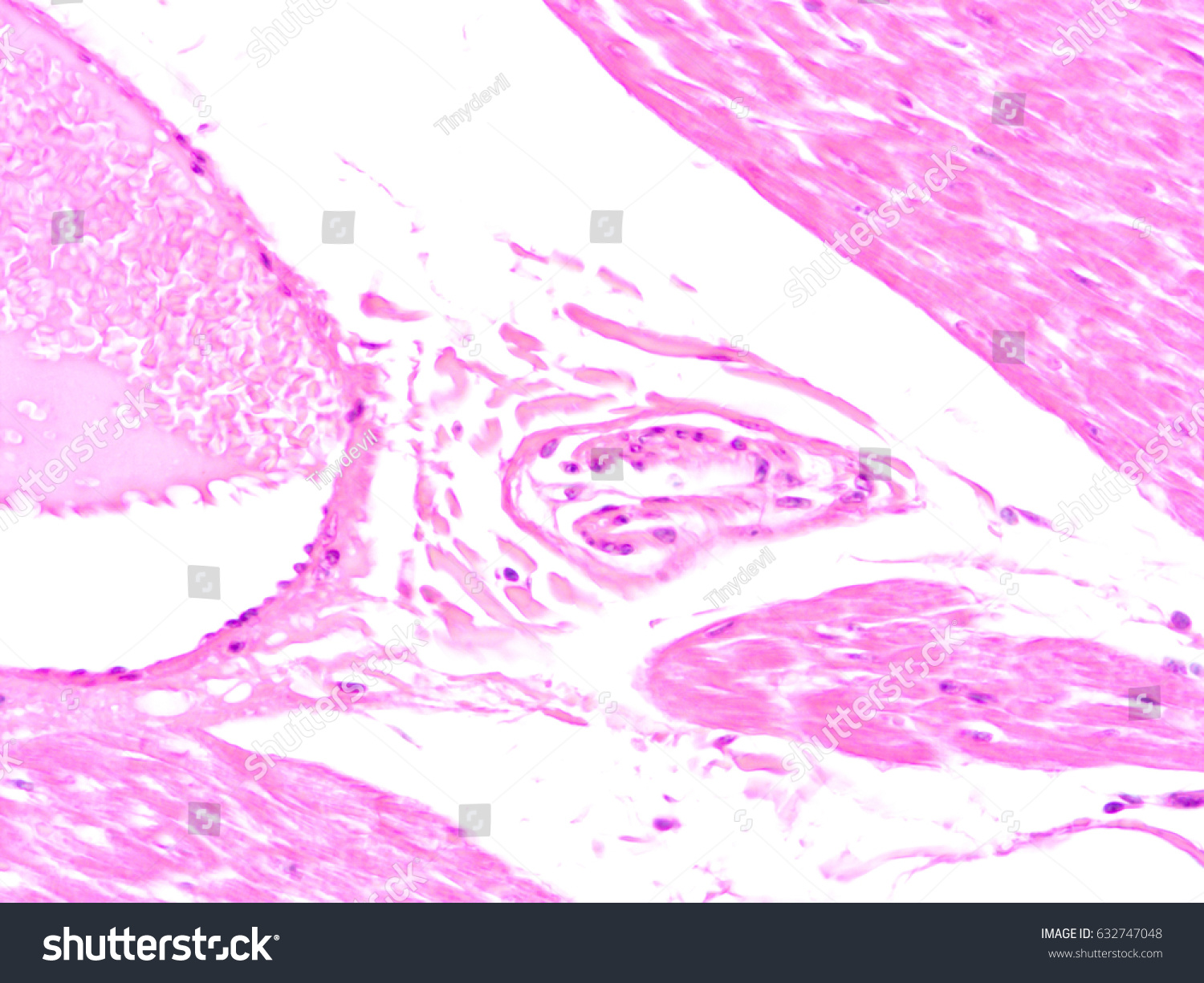 Histology Human Heart Tissue Show Cardiac Foto De Stock 632747048 ...