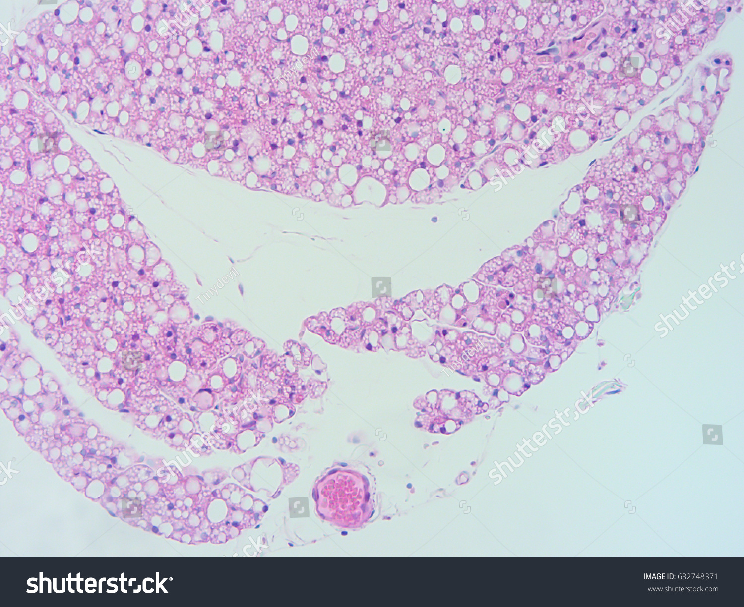 Histology Human Heart Tissue Show Cardiac Stock Photo 632748371 ...