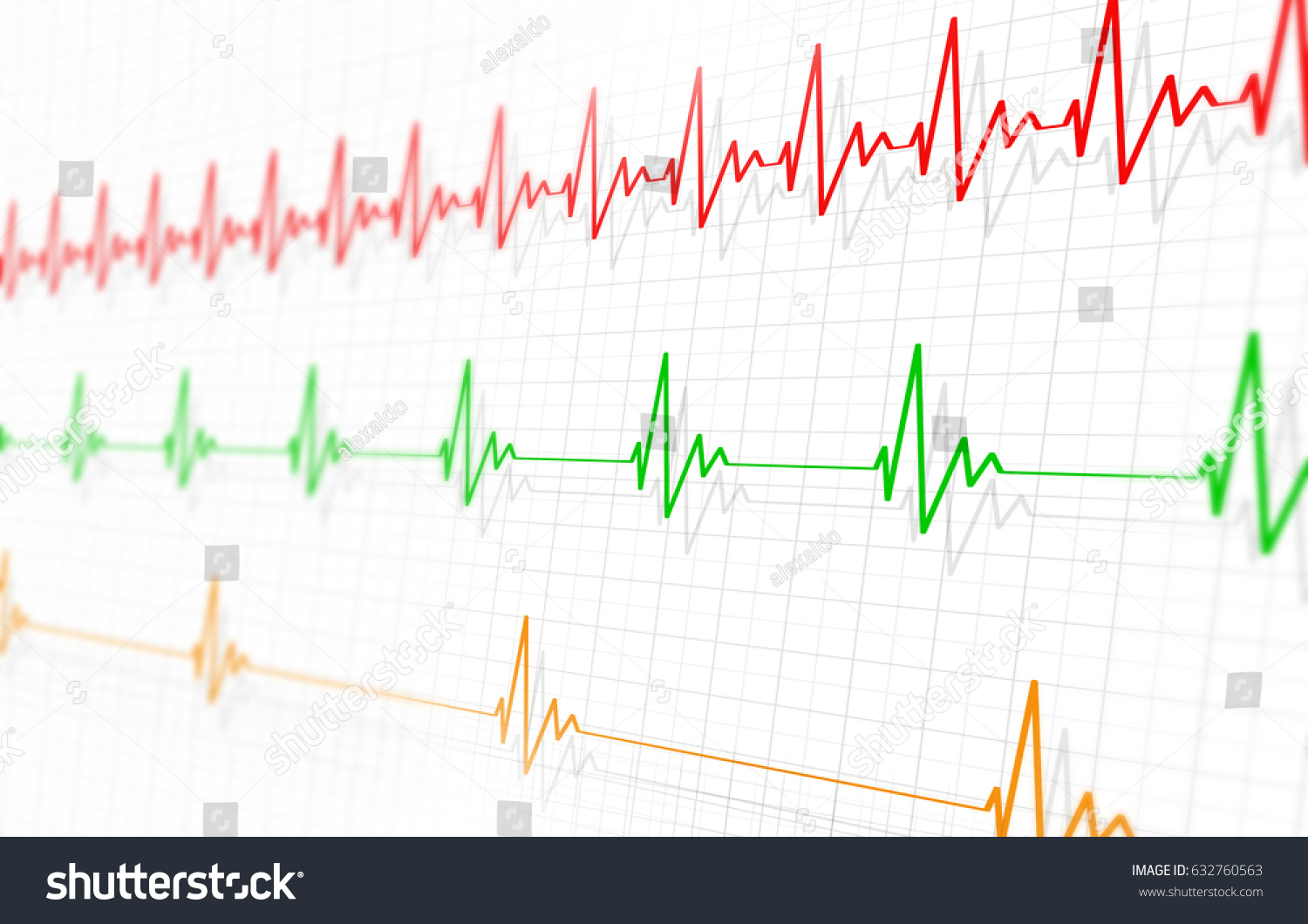 Pulse slowed. Рефлекторная тахикардия. Rapid Heart rate. The different Heartbeat.