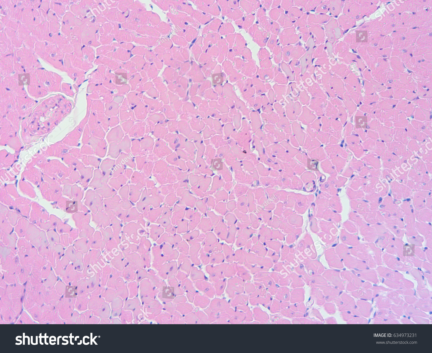 Histology Human Heart Tissue Show Cardiac Stock Photo 634973231 ...