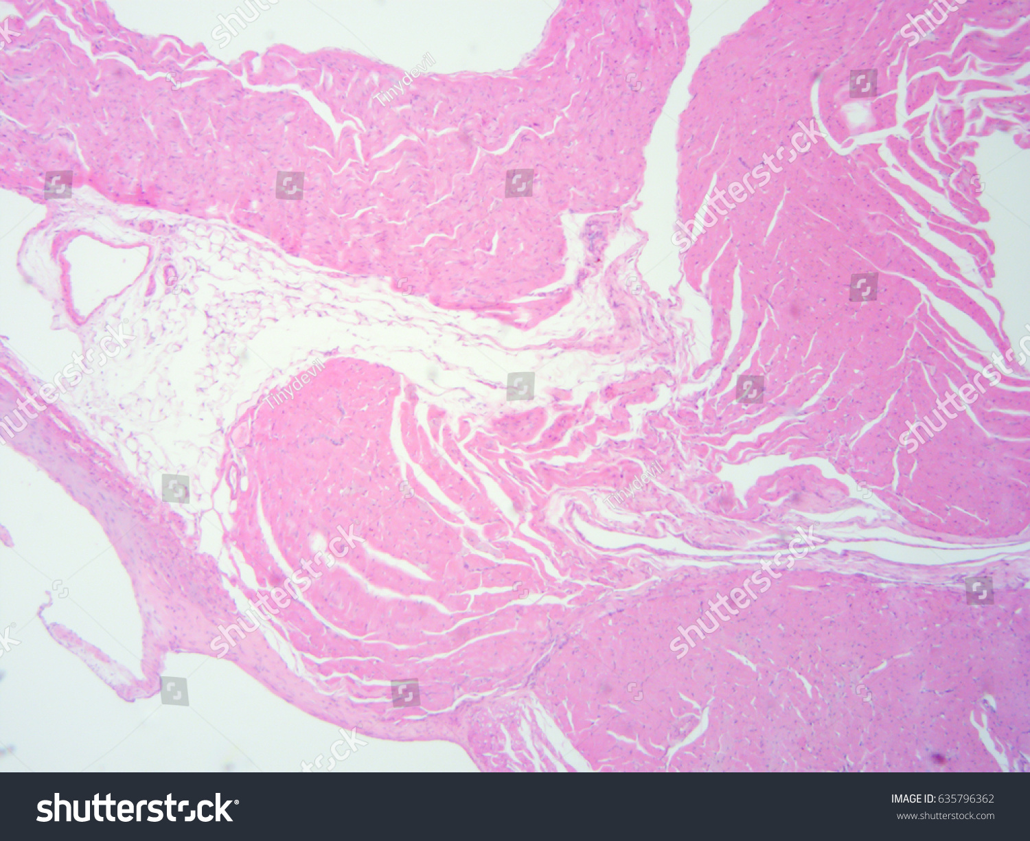 Histology Human Heart Tissue Show Cardiac Stock Photo 635796362 ...