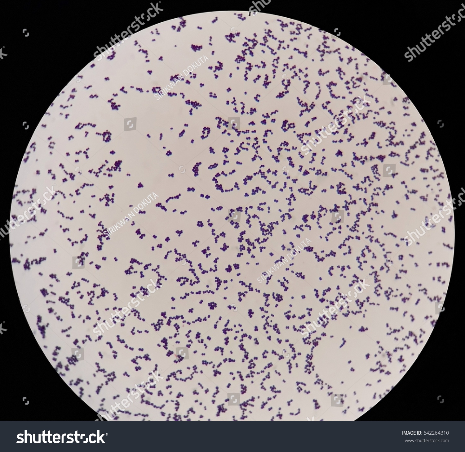 Smear Grams Stained Gram Positive Cocci Stock Photo 642264310 ...