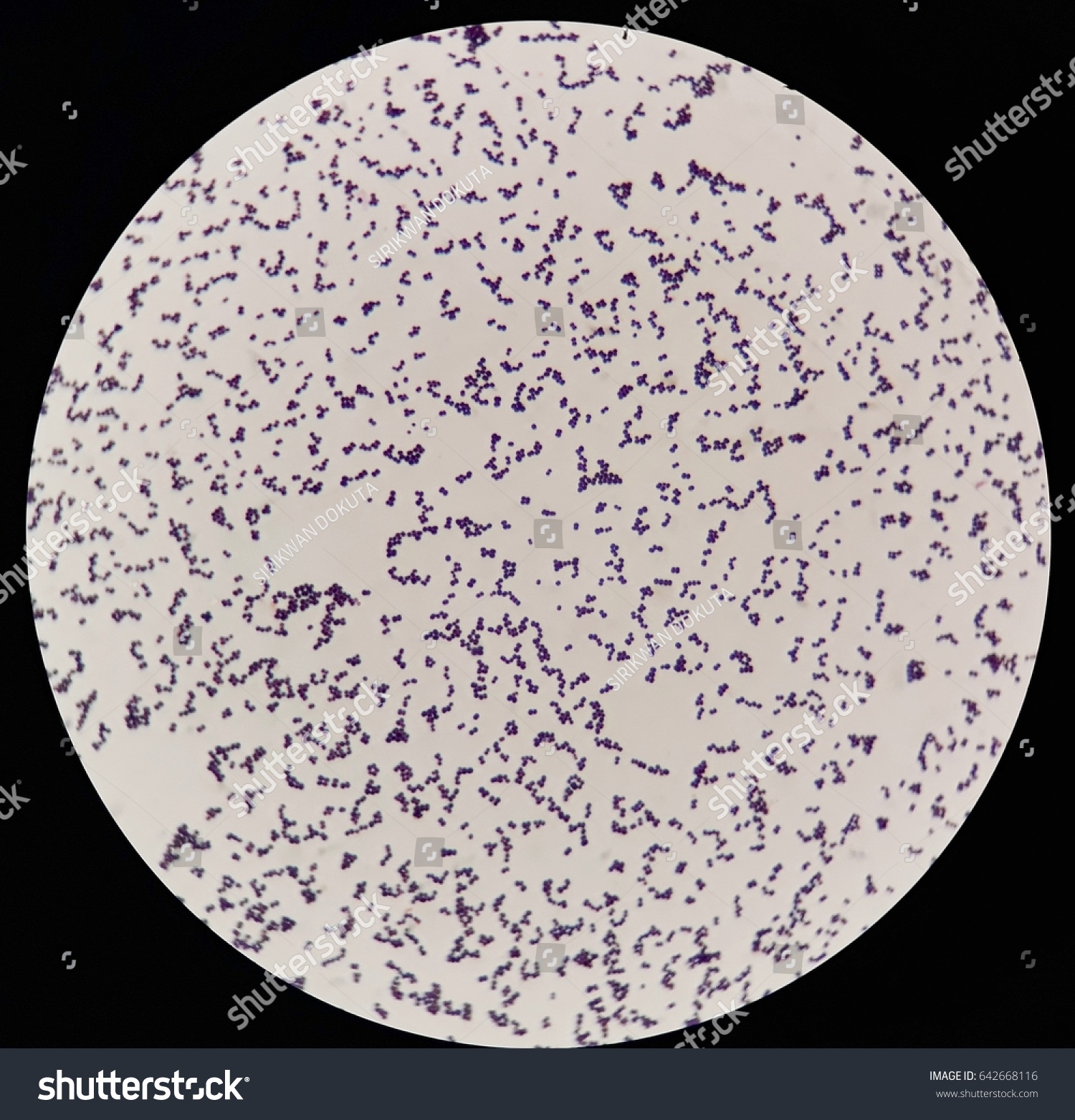 Smear Grams Stained Gram Positive Cocci Stock Photo 642668116 ...