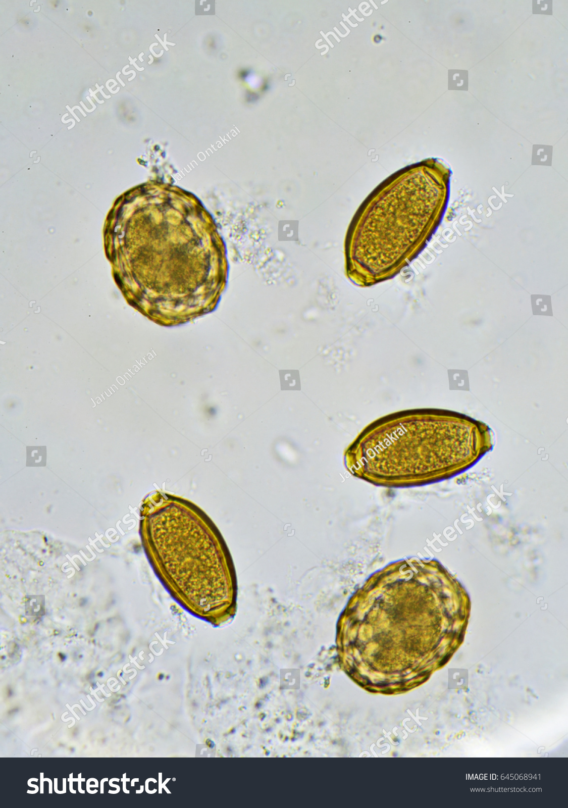 Ascaris lumbricoides яйца микроскоп