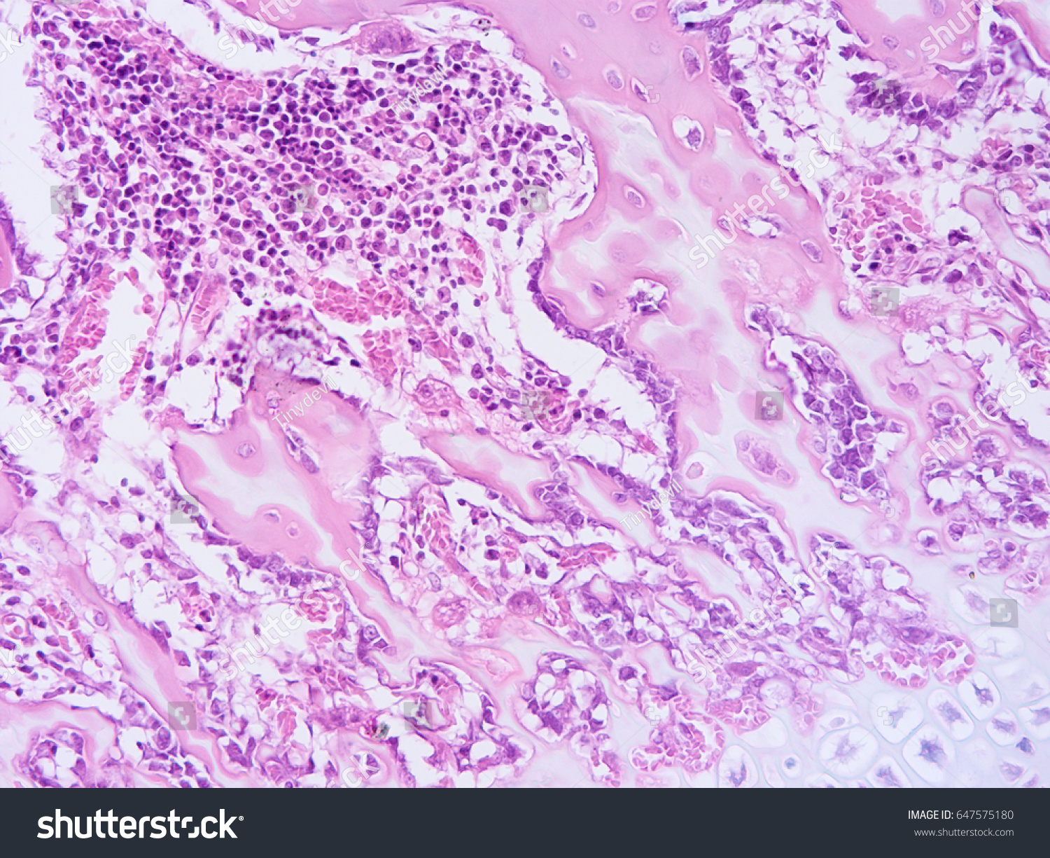 Histology Human Tissue Show Fibrous Cartilage Stock Photo 647575180 ...