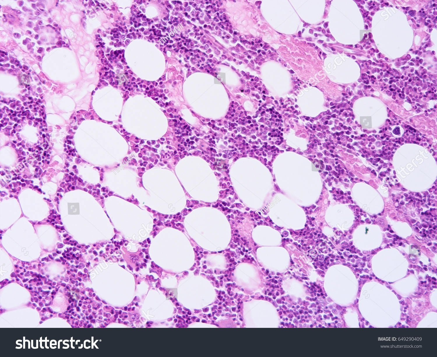 Histology Human Tissue Show Fibrous Cartilage Stock Photo 649290409 ...