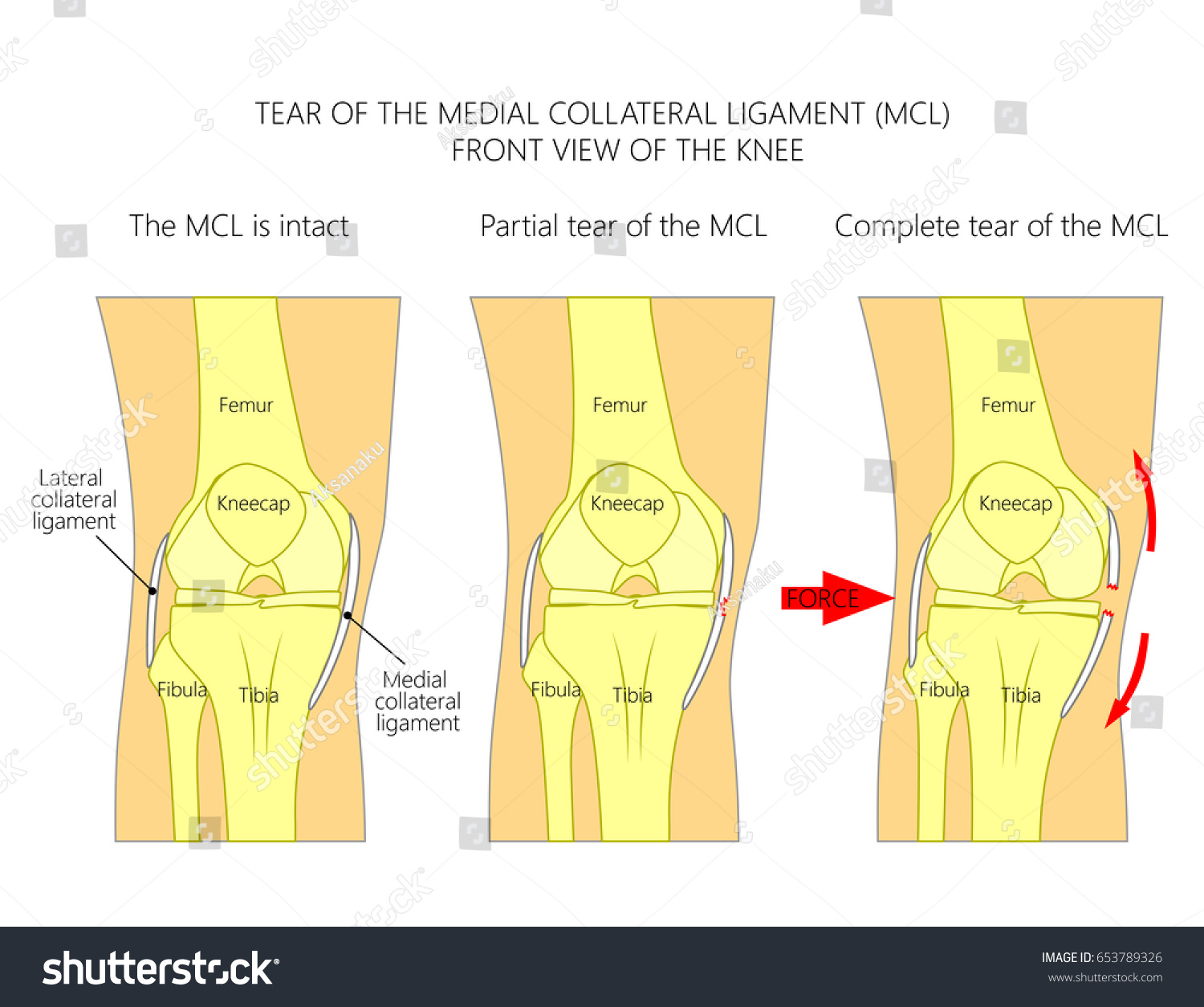 Vector Illustration Anatomy Knee Joint Healthy Stock Vector (Royalty ...